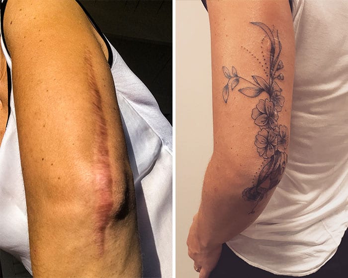 Here is another flower tattoo running part of the length of this person’s arm. Not only does the tattoo look good, it fully covers the scar on the back of this person’s arm, covering it completely.