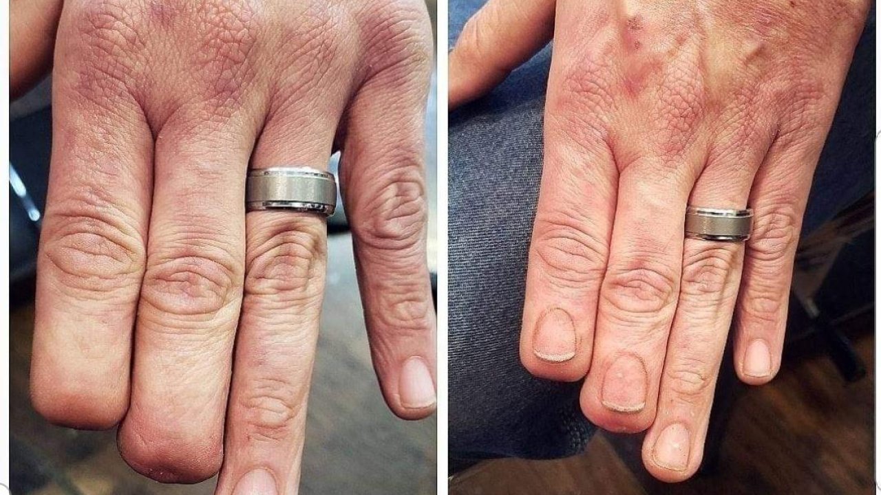 20 Tattoos That Turned Scars &#038; Birthmarks Into Works Of Art